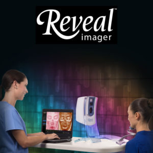 Reveal™ Imager